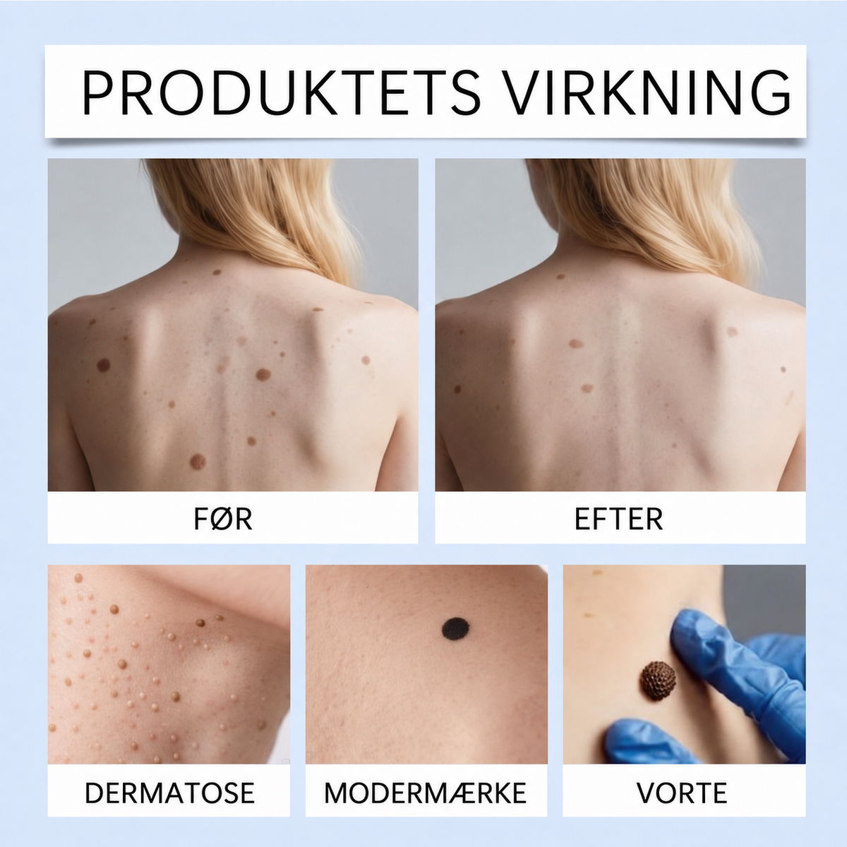 ClearRoller™ Roller Serum – avanceret til klar hud