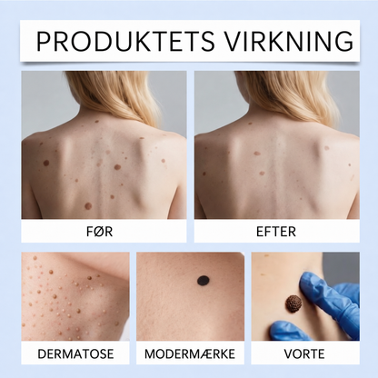 ClearRoller™ Roller Serum – avanceret til klar hud